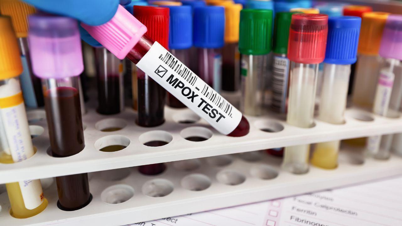 WHO Declares Mpox No Longer an International Health Emergency