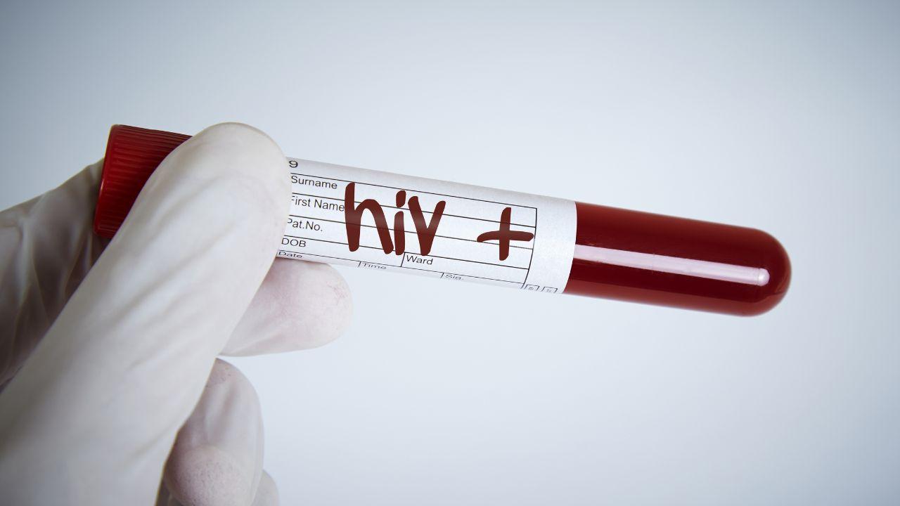 Canada’s Oldest HIV Agency, AIDS Committee of Toronto, to Close After 42 Years