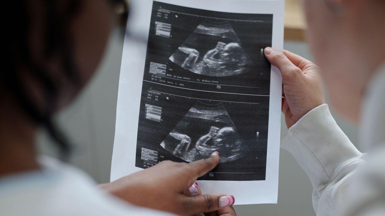 Columbia’s AI Tool Finds Elusive Sperm, Enables Conception After 19 Years