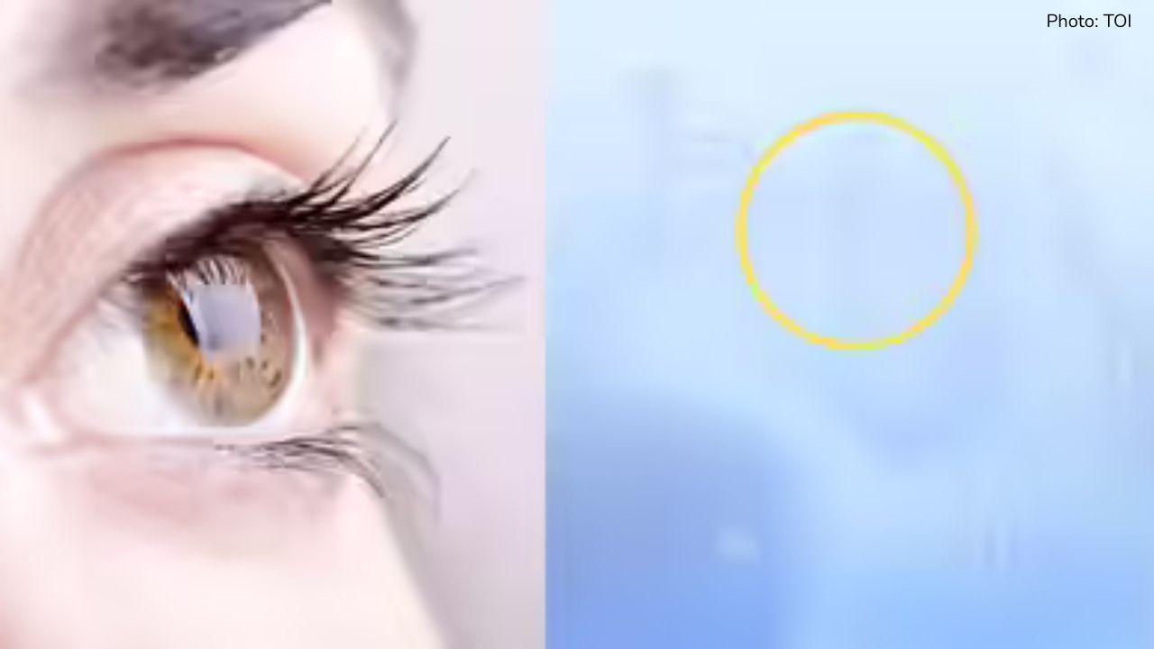 Why you may be seeing spots or floaters — eye experts explain