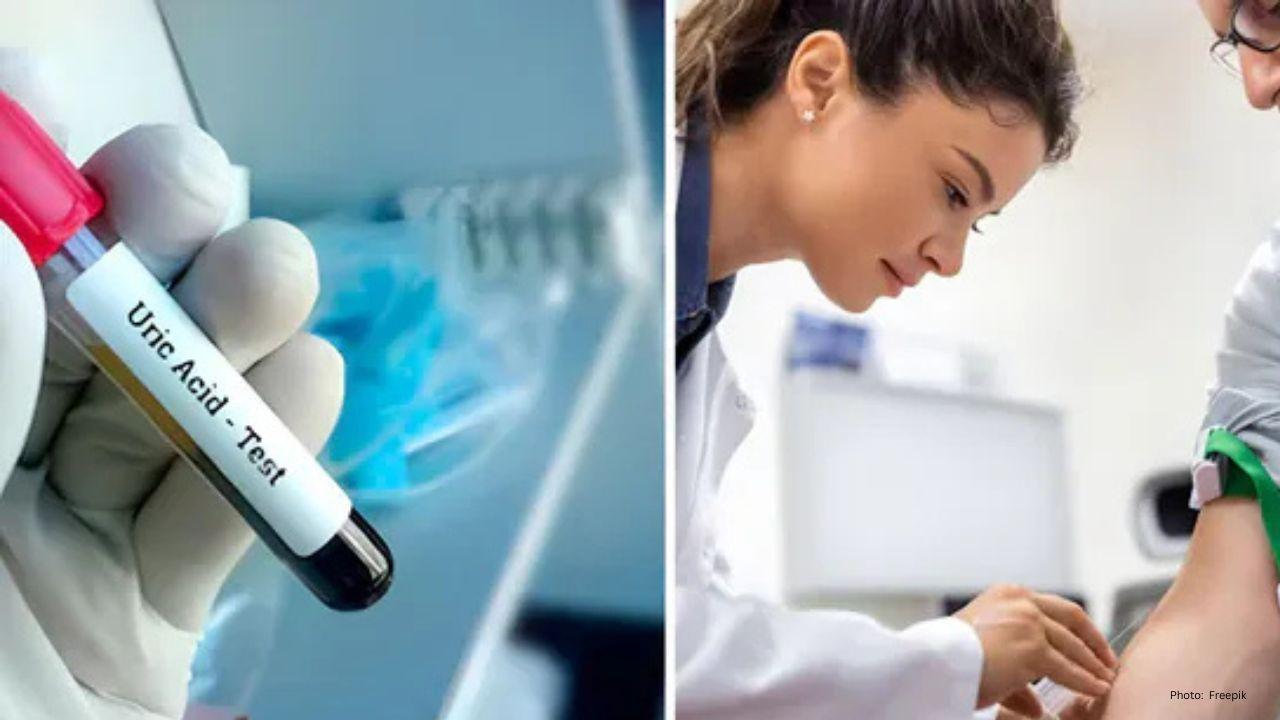 High Uric Acid? Five Conditions That Can Push Levels Higher