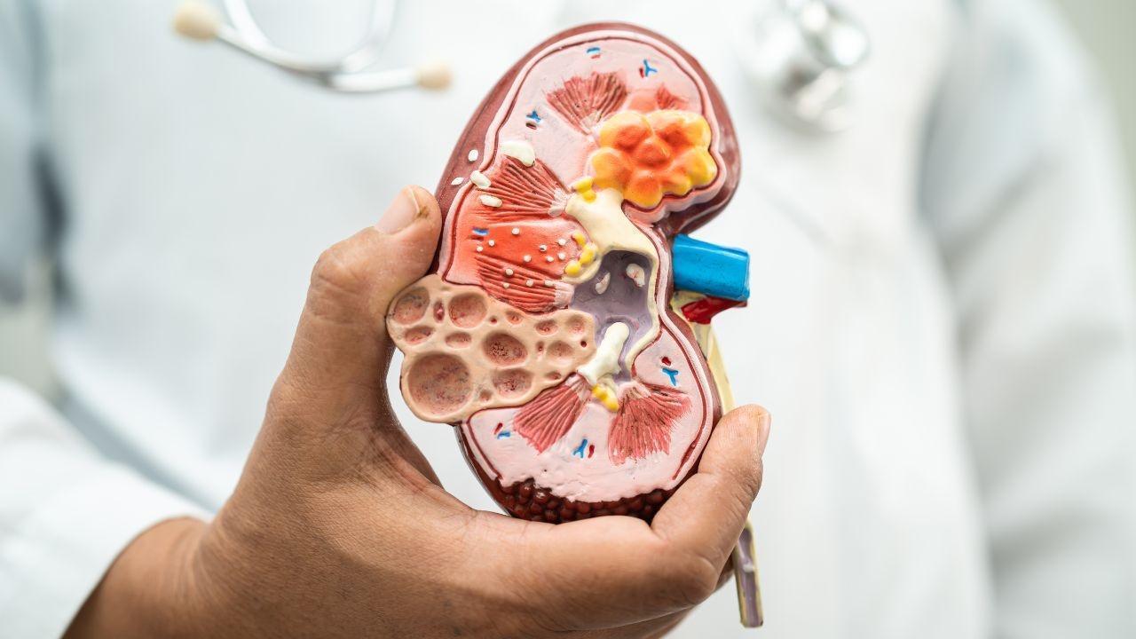 India's Chronic Kidney Disease Crisis Escalates in 2023