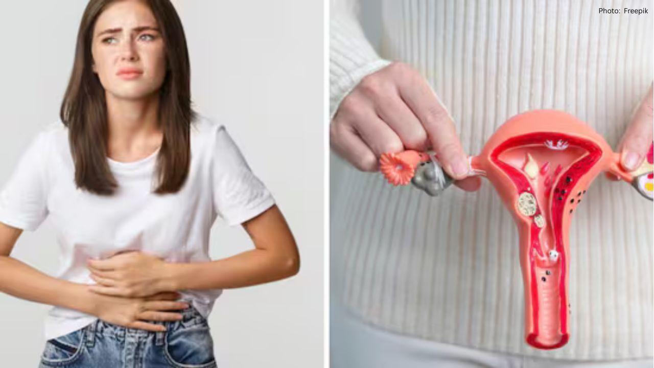 30-Year-Old Woman Uncovers Significant Fibroids During Routine Health Check