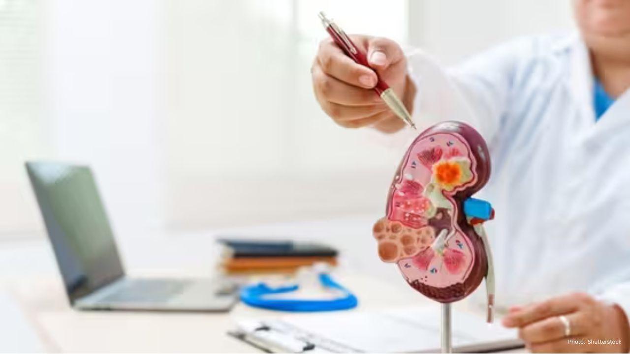 Breakthrough in PKD Research at University of California