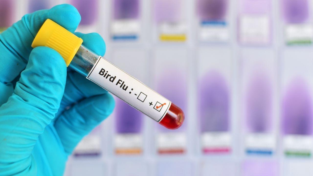 US Sees Its Initial Human Case of H5N5 Bird Flu