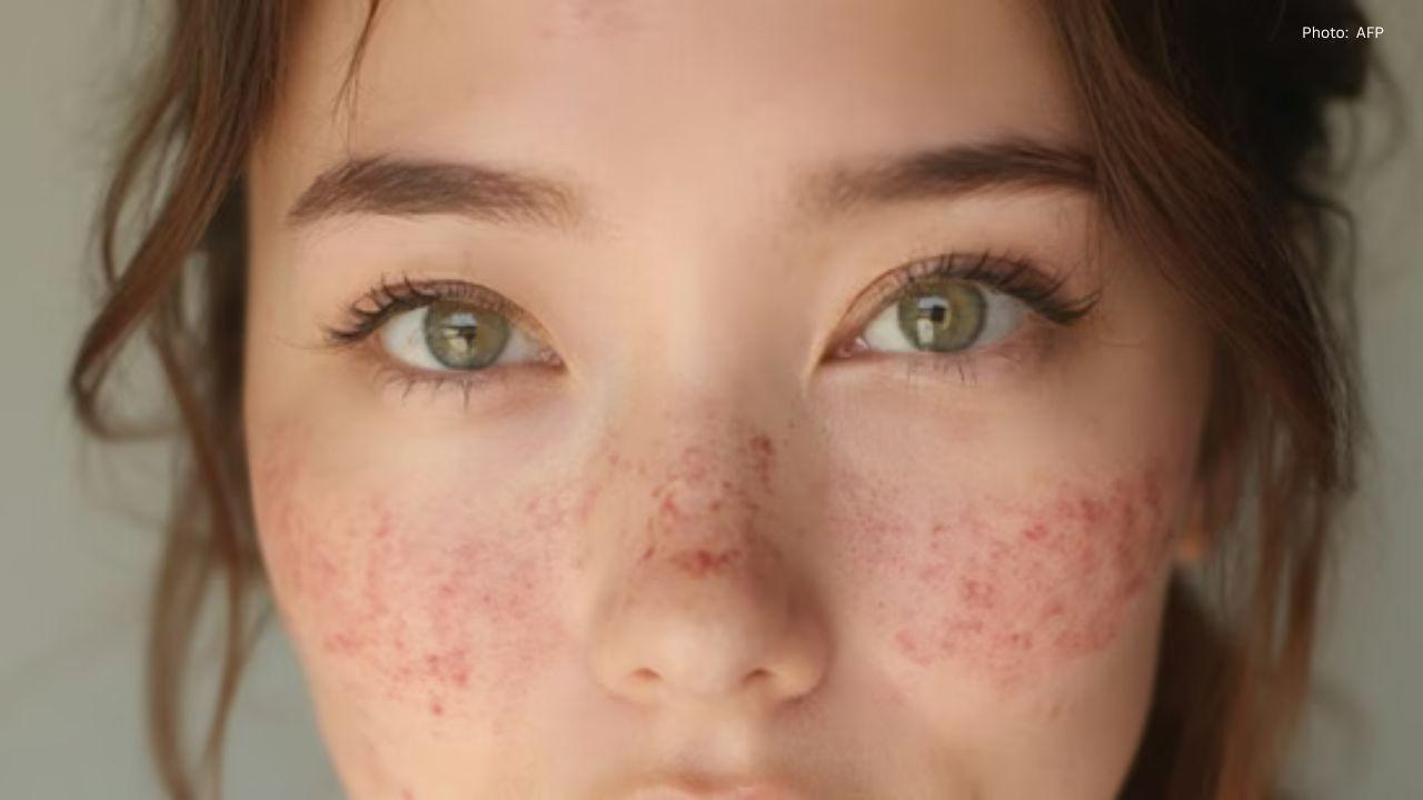 Essential Tips for Selecting the Ideal Winter Moisturizer