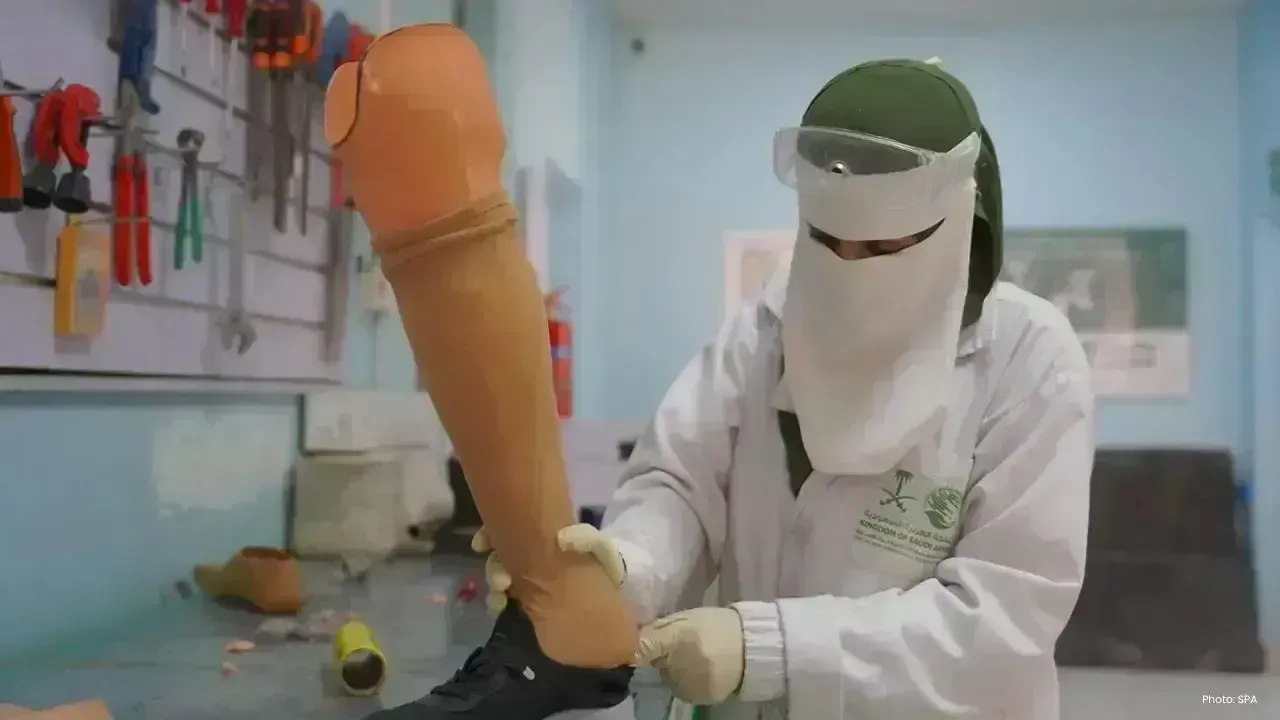 Saudi Arabia Aids 519 Patients at Hadhramaut Rehabilitation Facility