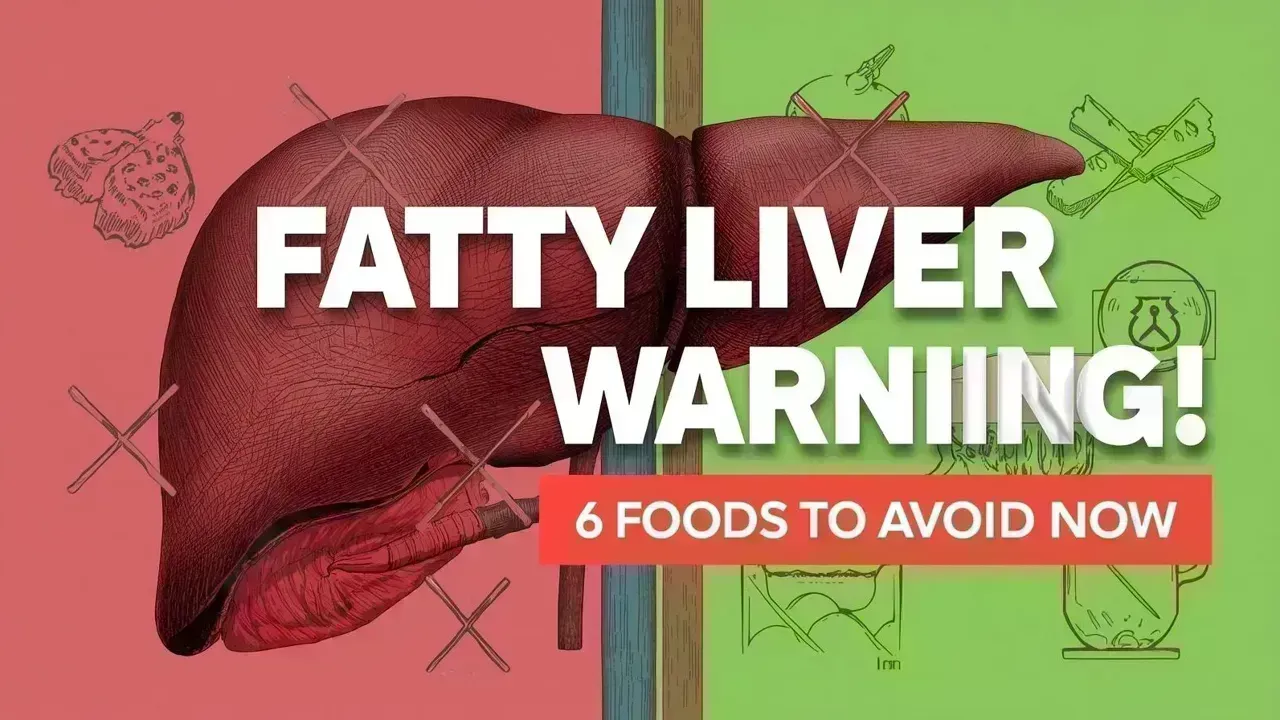 Top 6 Foods to Steer Clear of if You Have Fatty Liver