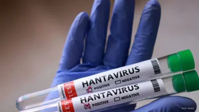 Ongoing Research Aims to Combat Hantavirus: Progress on Treatments and Vaccines