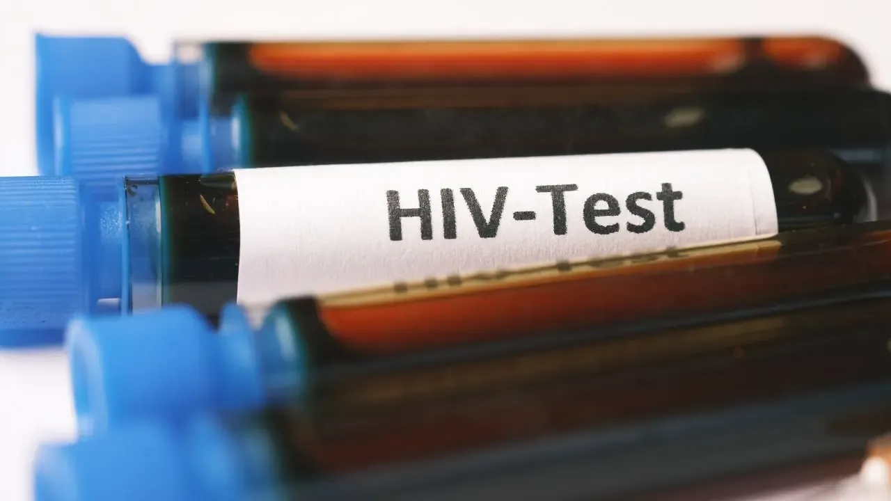 HIV Cases Continue to Rise in Chiang Mai, Officials Raise Concern
