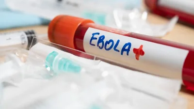 Congo Ebola Cases Cross 5,000 as Death Toll Rises